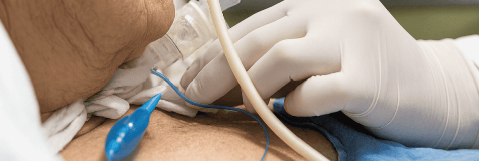 Atención de Pacientes Traqueostomizados a Domicilio con MAQMUN Médica. Aspiración de secreciones mediante circuito abierto y cerrado, con técnicas seguras con personal ex