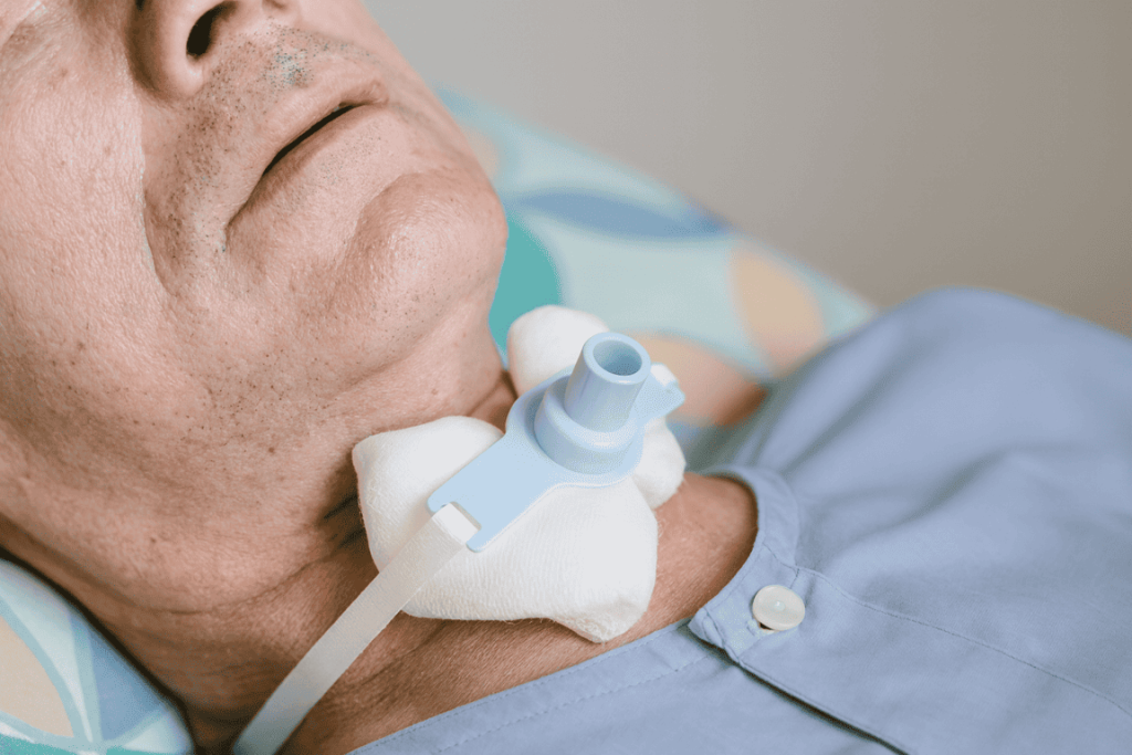 Atención de Pacientes Traqueostomizados a Domicilio con MAQMUN Médica. Cambio de cánula de traqueostomía, siguiendo protocolos clínicos con personal experto