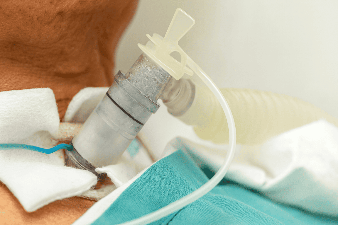 Atención de Pacientes Traqueostomizados a Domicilio con MAQMUN Médica. Cuidados y curación de traqueostomía, incluyendo cambio de sujetador con personal experto