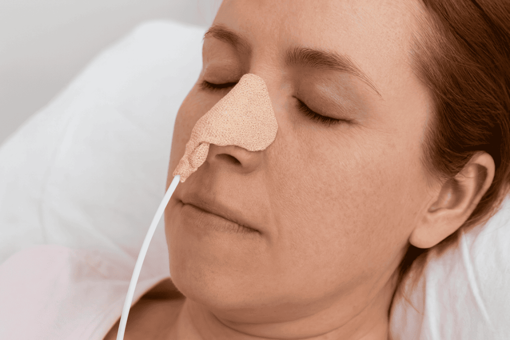 Atención profesional en Alimentación por sonda nasogástrica o sonda de gastrostomía, garantizando una nutrición adecuada en el domicilio a Domicilio con MAQMUN Médica