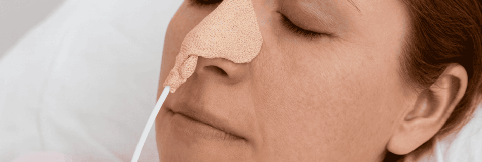 Atención profesional en Alimentación por sonda nasogástrica o sonda de gastrostomía, garantizando una nutrición adecuada en el domicilio a Domicilio con MAQMUN Médica